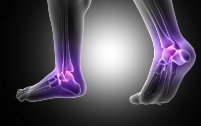 The Benefits of Glucosamine for Joint Health